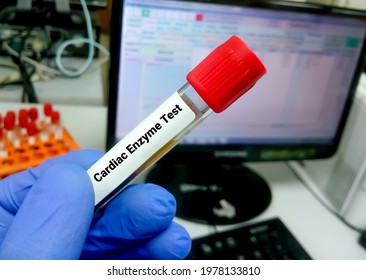 Blood Sample For Cardiac Enzyme Test, Myocardial Infarction (MI)