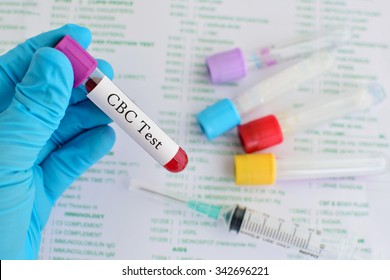 Blood Sample Cbc Complete Blood Count Stock Photo 342696221 | Shutterstock