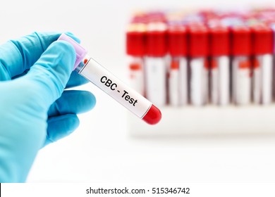 Blood Sample Cbc Complete Blood Count Stock Photo 515346742 | Shutterstock