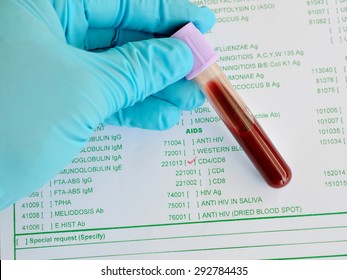 Blood Sample For CD4/CD8 Testing