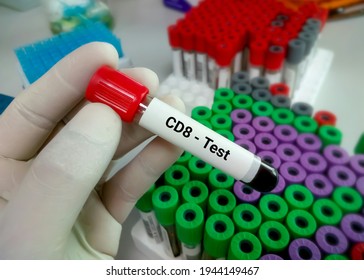 Blood Sample For CD8 Test