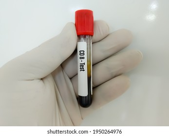 Blood Sample For CD8 Test