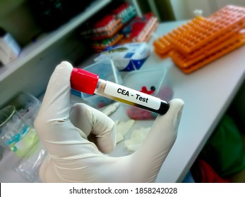 Blood Sample For CEA Test, Tumor Marker For Colon Cancer