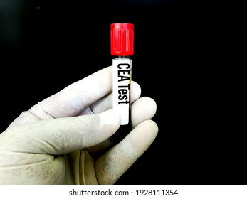 Tumor Sample High Res Stock Images Shutterstock