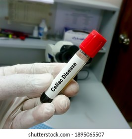 Blood Sample For Celiac Disease