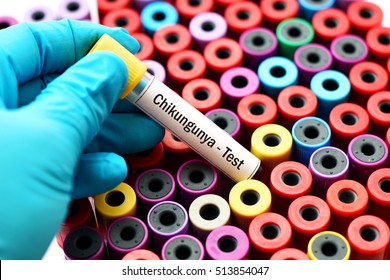 Blood Sample For Chikungunya Virus Test