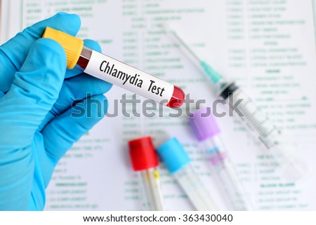 Blood sample for Chlamydia test