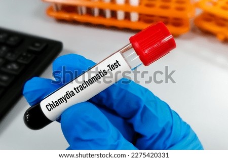 Blood sample with Chlamydia trachomatis test order. STD, STI