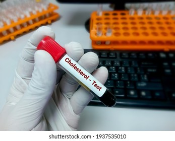 Blood Sample For Cholesterol Test