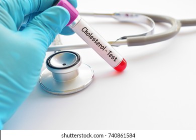 Blood Sample For Cholesterol Test