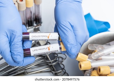 Blood sample for cholesterol testing.