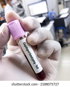 Blood Sample For Clopidogrel Genotyping Test. CYP2C19 Genotyping.