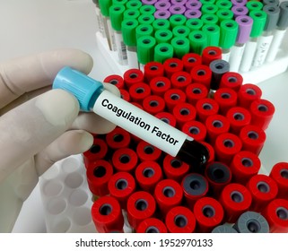 Blood Sample For Coagulation Factor Testing, Diagnosis Of Bleeding Disorder