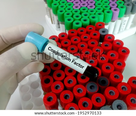 Blood sample for coagulation factor testing, diagnosis of bleeding disorder