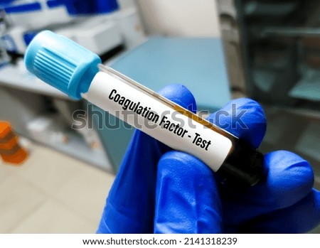 Blood sample for coagulation factor testing.