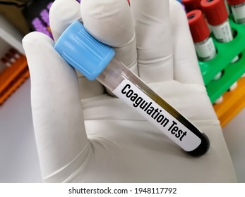 Blood Sample For Coagulation Test. Medical Or Health Concept.