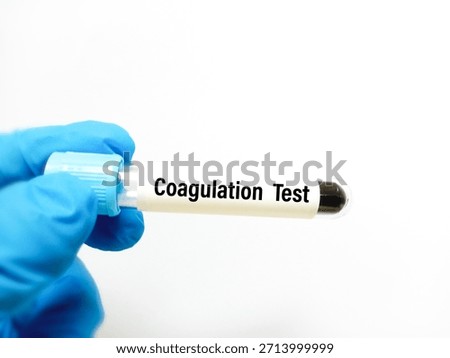 Blood sample for coagulation test. Blood sample for coagulation testing, PT, APTT.