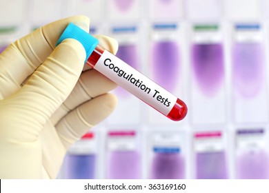 Blood Sample For Coagulation Testing