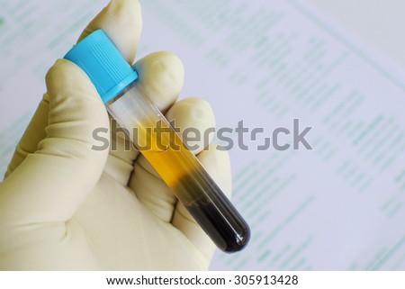 Blood sample for coagulation testing 