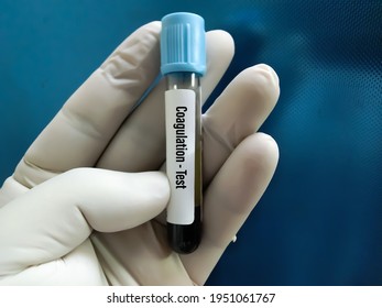 Blood Sample For Coagulation Testing At Medical Laboratory