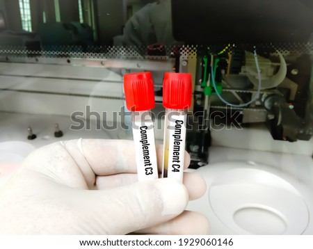 Blood Sample for Complement  C3, C4 Test with laboratory background. Closeup. Diagnosis of autoimmune disorders.