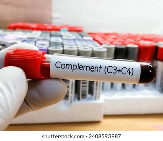 Blood sample for complement (C3+C4) test