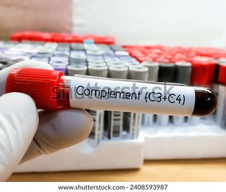 Blood sample for complement (C3+C4) test