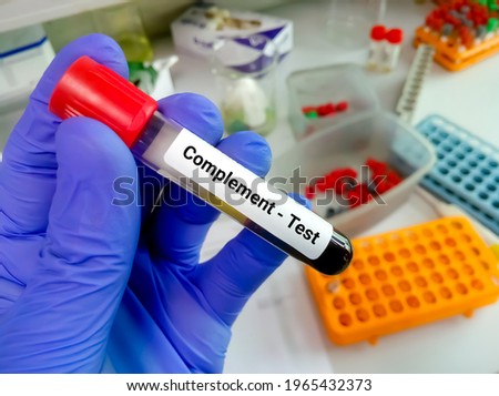 Blood sample for complement test, diagnosis of autoimmune disorders