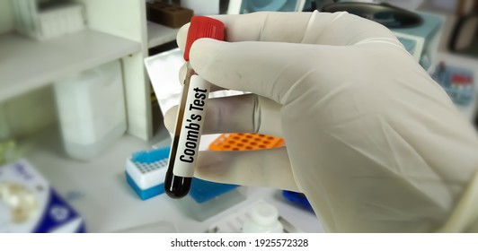 Blood sample for Coomb's test, rh incompatibility