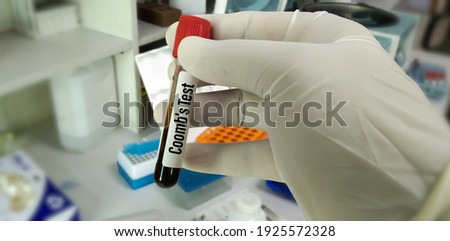 Blood sample for Coomb's test, rh incompatibility