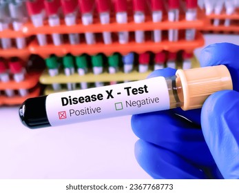Blood sample for Disease X test. Disease X is the mysterious name given to the very serious threat that unknown viruses pose to human health