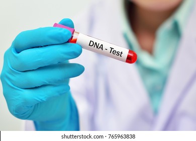 Blood Sample For DNA Test