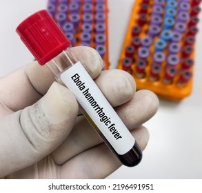 Blood Sample For Ebola Hemorrhagic Fever Test To Help Diagnose Ebola. It's A Rare And Deadly Disease.