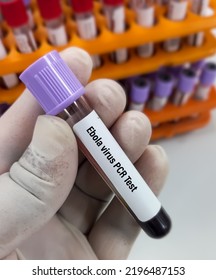 Blood Sample For Ebola Virus PCR Test To Identify Viral Hemorrhagic Fever. Ebola Is A Rare And Deadly Disease.