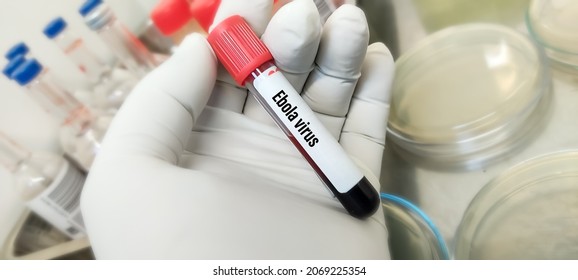 Blood sample for Ebola virus test to identify viral hemorrhagic fever, Ebola is a rare and deadly disease first discovered in 1976 near the Ebola River in Congo