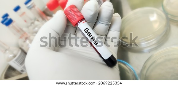 Blood sample for Ebola virus
test to identify viral hemorrhagic fever, Ebola is a rare and
deadly disease first discovered in 1976 near the Ebola River in
Congo