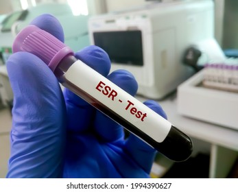 Erythrocyte Sedimentation Rate The Blood Project