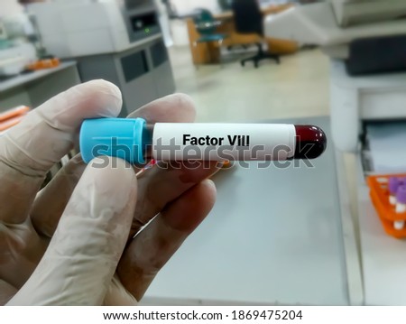 Blood Sample for Factor VIII. Blood coagulation testing. Medical or health concept. coagulation factor test. Antihemophilia factor A test