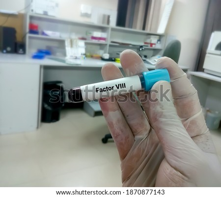Blood Sample for Factor VIII. Blood coagulation testing. Medical or health concept. coagulation factor test. Antihemophilia factor A test
