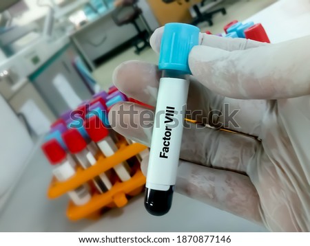 Blood Sample for Factor VIII. Blood coagulation testing. Medical or health concept. coagulation factor test. Antihemophilic factor A test