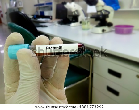 Blood sample for factor XI or plasma thromboplastin antecedent diagnosis of coagulation disorder