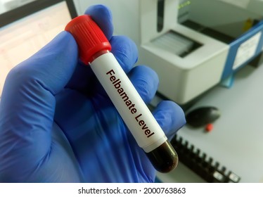 Blood Sample For Felbamate Test. Seizures, Epilepsy