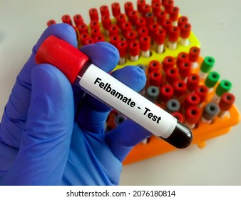 Blood Sample For Felbamate Test. Seizures, Epilepsy