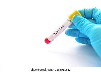 Blood Sample For Fluorescence In Situ Hybridization Or FISH Test, Laboratory Method For Chromosome Study