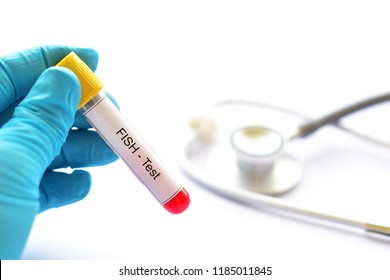 Blood Sample For Fluorescence In Situ Hybridization Or FISH Test, Laboratory Method For Chromosome Study