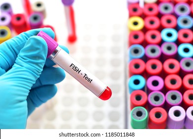 Blood Sample For Fluorescence In Situ Hybridization Or FISH Test, Laboratory Method For Chromosome Study