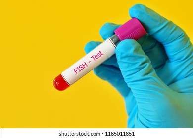 Blood Sample For Fluorescence In Situ Hybridization Or FISH Test, Laboratory Method For Chromosome Study