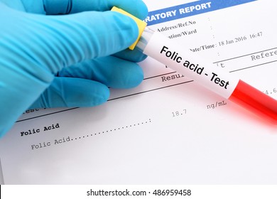 Blood Sample With Folic Acid Testing Result