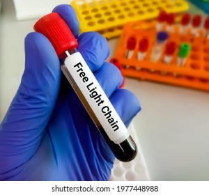 Blood Sample For Free Light Chain Test. Diagnosis For Plasma Cell Disorders 