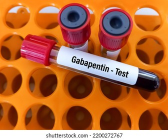 Blood Sample For Gabapentin Level Test. Set Therapeutic Dose. Epilepsy, Seizures.